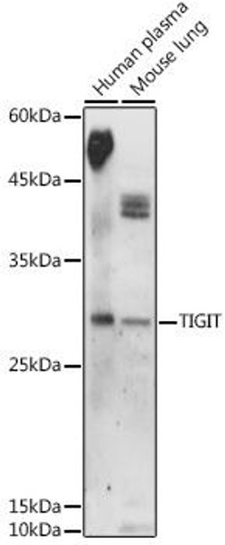 Anti-TIGIT Antibody CAB20350