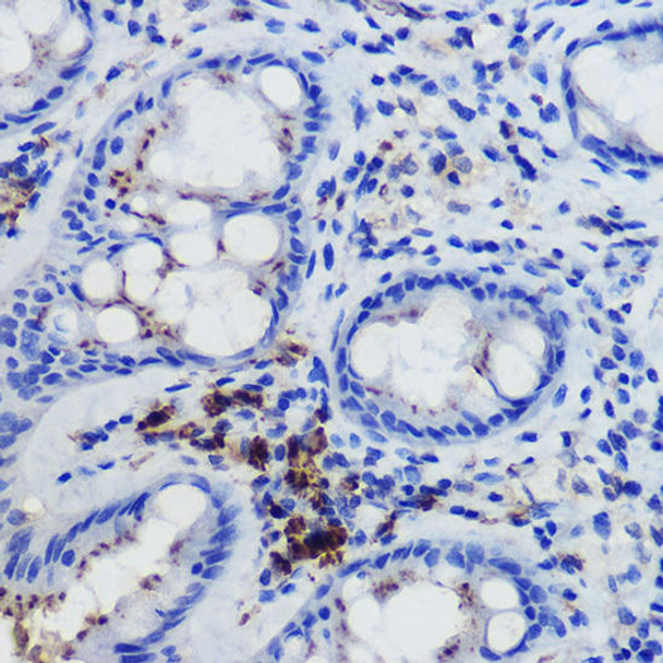 Anti-FPR1 Antibody CAB20455
