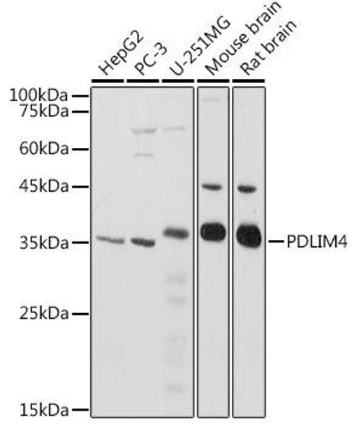 Anti-PDLIM4 Antibody CAB20463