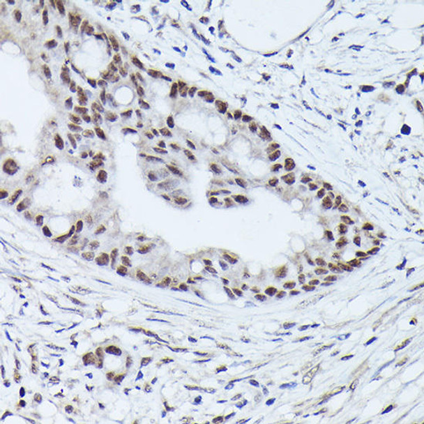 Anti-WDR46 Antibody CAB20466