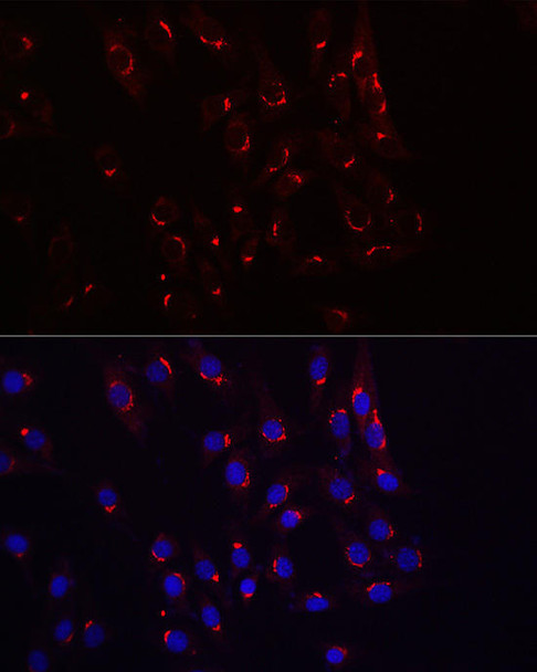 Anti-TJAP1 Antibody CAB20532