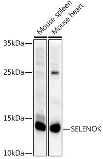 Anti-SELENOK Antibody CAB20560