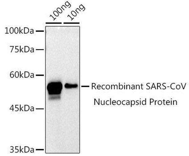 Anti-SARS-CoV-2 N Protein Antibody CAB20607