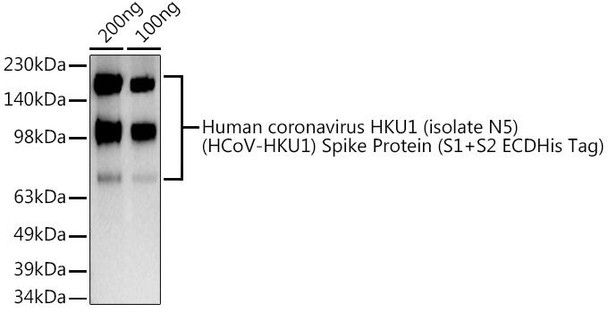 Anti-HCoV-HKU1 Spike S1 Antibody CAB20613