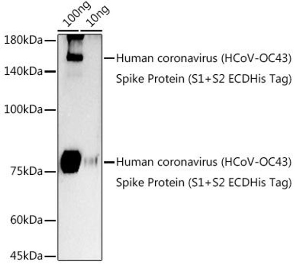 Anti-HCoV-OC43 Spike S2 Antibody CAB20616