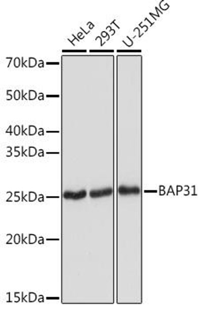 Anti-BAP31 Antibody CAB2259