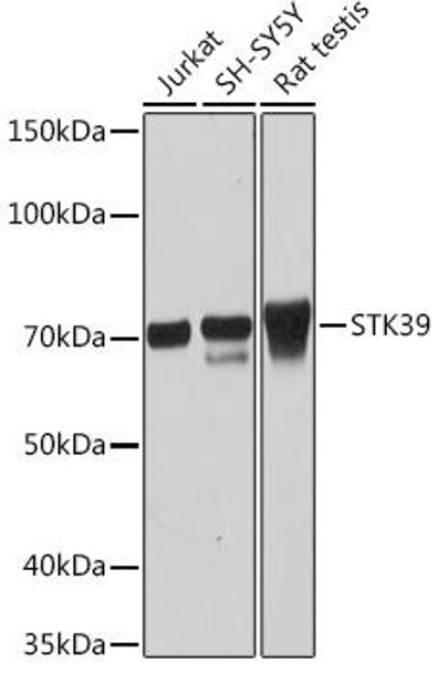 Anti-STK39 Antibody CAB2275
