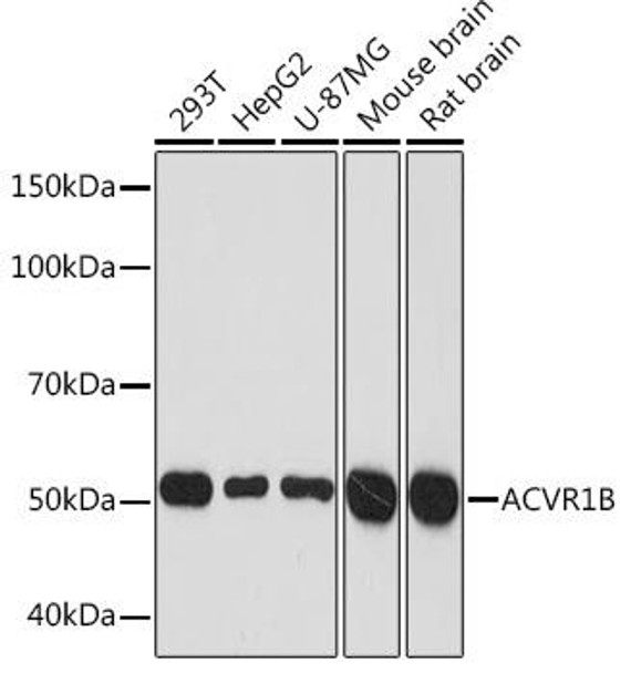 Anti-ACVR1B Antibody CAB2279