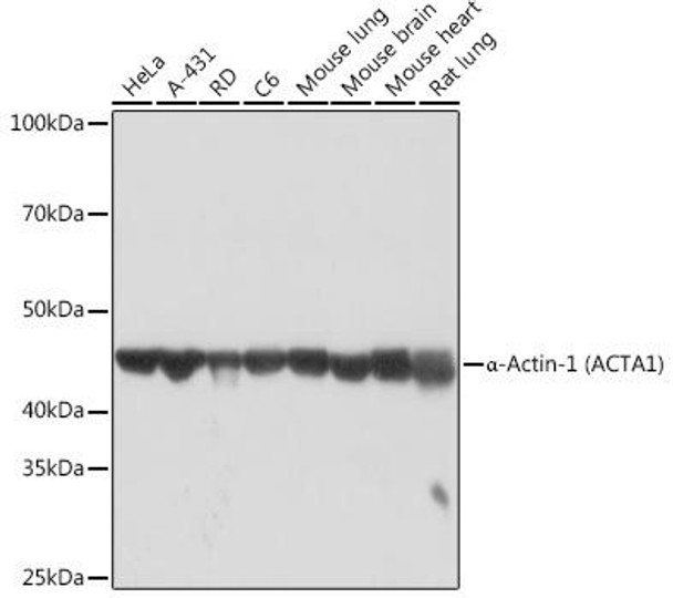 Anti-alpha-Actin-1 ACTA1 Antibody CAB2280
