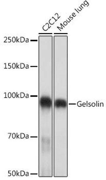 Anti-Gelsolin Antibody CAB2612