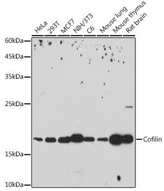 Anti-Cofilin Antibody CAB2658