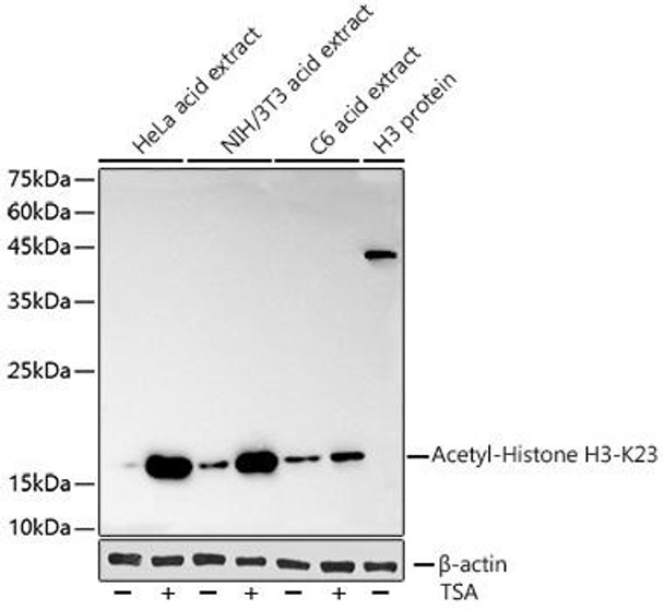 Anti-Acetyl-Histone H3-K23 Antibody CAB2771