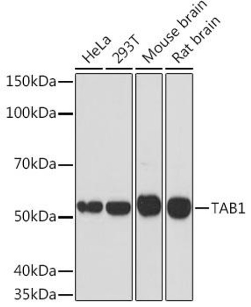 Anti-TAB1 Antibody CAB3306