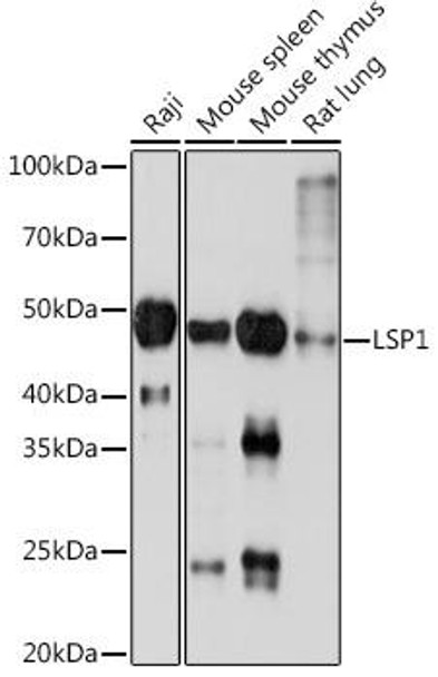 Anti-LSP1 Antibody CAB3355