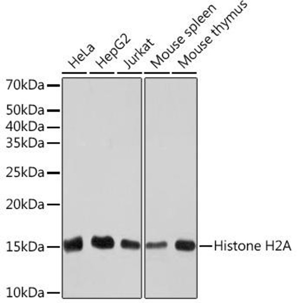 Anti-Histone H2A Antibody CAB3692