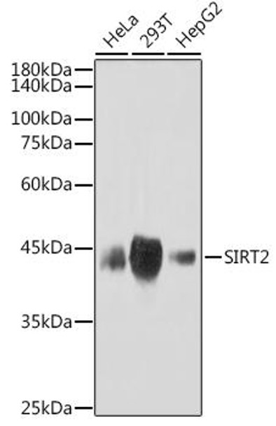 Anti-SIRT2 Antibody CAB3967