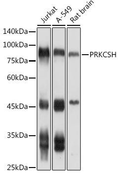 Anti-PRKCSH Antibody CAB4045