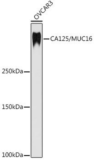 Anti-CA125 / MUC16 Antibody CAB4666