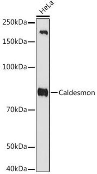 Anti-Caldesmon Antibody CAB4884