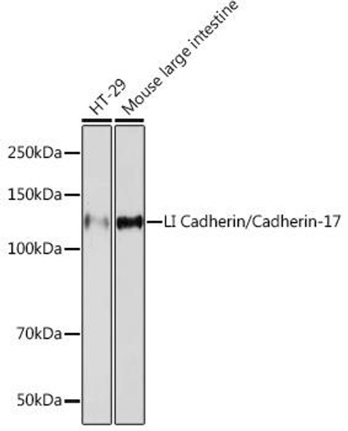 Anti-LI Cadherin/Cadherin-17 Antibody CAB5286