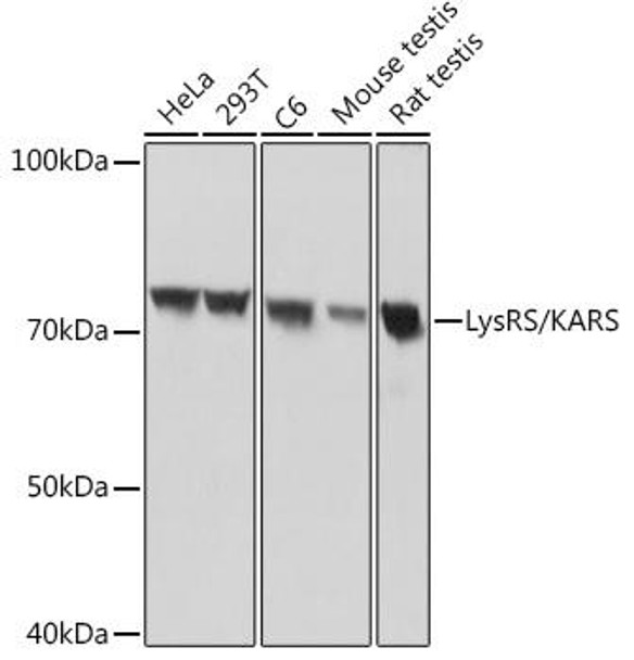 Anti-LysRS/KARS Antibody CAB8648