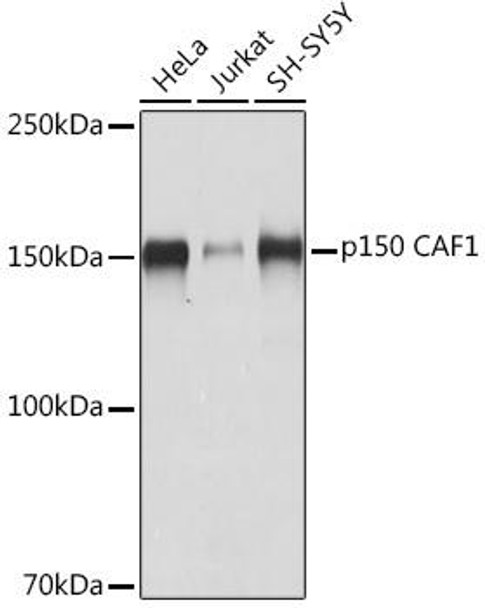 Anti-p150 CAF1 Antibody CAB8725