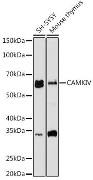 Anti-CAMKIV Antibody CAB9271