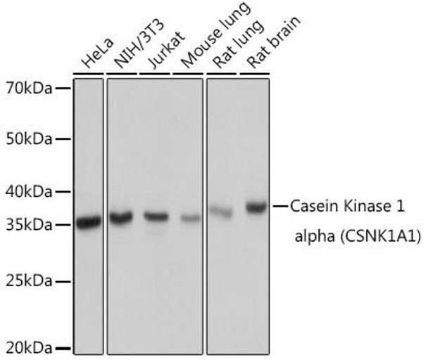 Anti-Casein Kinase 1 alpha CSNK1A1 Antibody CAB9308