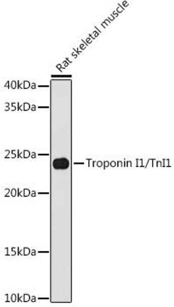 Anti-Troponin I1/TnI1 Antibody CAB9664