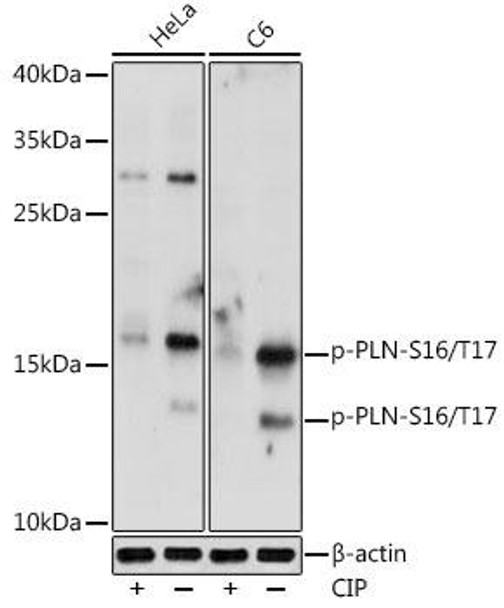 Anti-Phospho-PLN-S16/T17 Antibody CABP0956