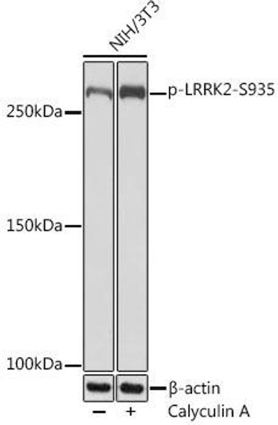 Anti-Phospho-LRRK2-S935 Antibody CABP1154