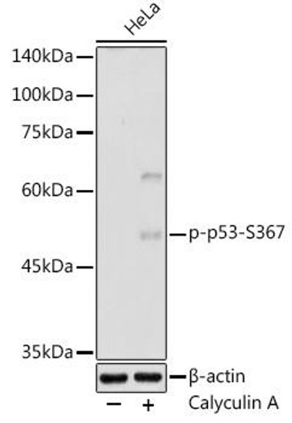 Anti-Phospho-p53-S367 Antibody CABP1170