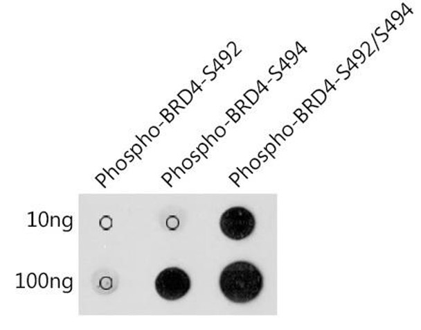 Anti-Phospho-BRD4-S492/S494 Antibody CABP1178