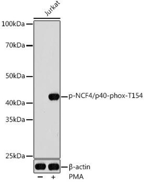 Anti-Phospho-NCF4/p40-phox-T154 Antibody CABP1193