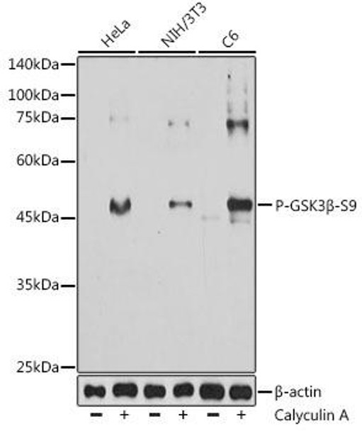 Anti-Phospho-GSK3beta-S9 Antibody CABP1258
