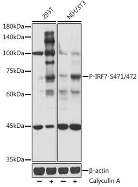 Anti-Phospho-IRF7-S471/472 Antibody CABP1264