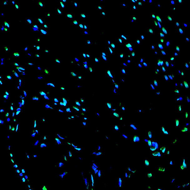 Paraffin embedded rat heart was treated with DNase I to fragment the DNA. DNA strand breaks showed intense fluorescent staining in DNase I treated sample (green). The cells were counterstained with DAPI (blue). This photo was taken by confocal microscope.