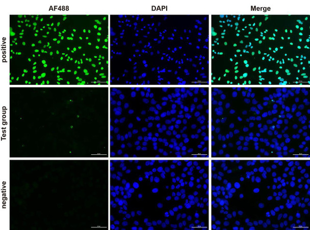 Fluorescence microscope analysis of camptothecin-induced apoptosis of Hela cells.