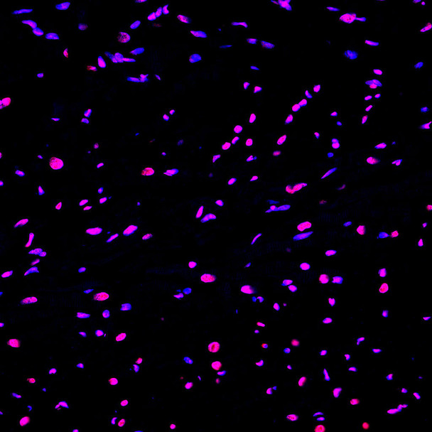 Paraffin embedded rat heart was treated with DNase I to fragment the DNA. DNA strand breaks showed intense fluorescent staining in DNase I treated sample (red). The cells were counterstained with DAPI (blue). This photo was taken by confocal microscope.