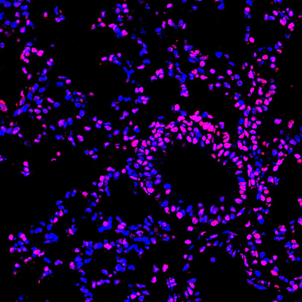 Paraffin embedded mouse lung was treated with DNase I to fragment the DNA. DNA strand breaks showed intense fluorescent staining in DNase I treated sample (red). The cells were counterstained with DAPI (blue). This photo was taken by confocal microscope.