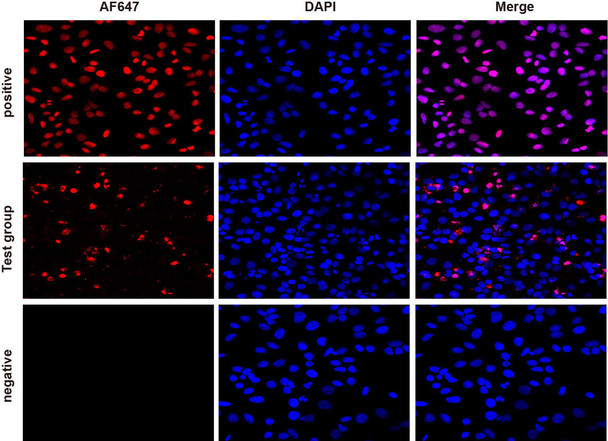 Fluorescence microscope analysis of camptothecin-induced apoptosis of Hela cells.