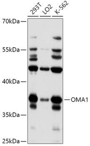 Western blot analysis of extracts of various cell lines, using OMA1 antibody at 1:1000 dilution. Secondary antibody: HRP Goat Anti-Rabbit IgG (H+L) at 1:10000 dilution. Lysates/proteins: 25ug per lane. Blocking buffer: 3% nonfat dry milk in TBST. Detection: ECL Basic Kit. Exposure time: 60s.