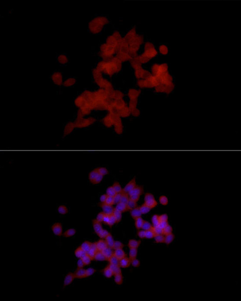 Immunofluorescence analysis of SH-SY5Y cells using PGP9. 5/UCHL1 Rabbit mAb at dilution of 1:100 (40x lens). Blue: DAPI for nuclear staining.