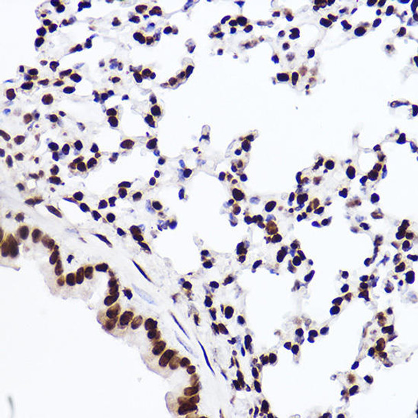 Immunohistochemistry of paraffin-embedded rat brain using MonoMethyl-Histone H3-K18 Rabbit mAb at dilution of 1:100 (40x lens). Perform high pressure antigen retrieval with 10 mM citrate buffer pH 6. 0 before commencing with IHC staining protocol.