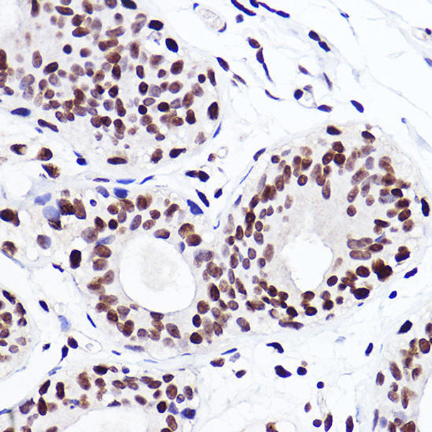 Immunohistochemistry of paraffin-embedded mouse lung using MonoMethyl-Histone H3-K18 Rabbit mAb at dilution of 1:100 (40x lens). Perform high pressure antigen retrieval with 10 mM citrate buffer pH 6. 0 before commencing with IHC staining protocol.