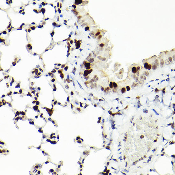 Immunohistochemistry of paraffin-embedded mouse lung using MCM2 Rabbit mAb at dilution of 1:100 (40x lens). Perform high pressure antigen retrieval with 10 mM citrate buffer pH 6. 0 before commencing with IHC staining protocol.