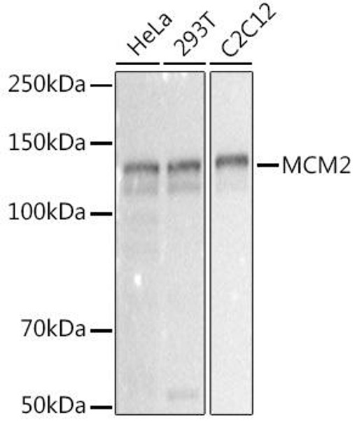 Western blot analysis of extracts of various cell lines, using MCM2 antibody at 1:1000 dilution. Secondary antibody: HRP Goat Anti-Rabbit IgG (H+L) at 1:10000 dilution. Lysates/proteins: 25ug per lane. Blocking buffer: 3% nonfat dry milk in TBST. Detection: ECL Basic Kit. Exposure time: 0. 3s.