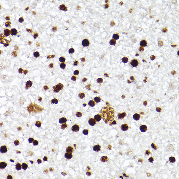 Immunohistochemistry of paraffin-embedded mouse liver using MCM2 Rabbit mAb at dilution of 1:100 (40x lens). Perform high pressure antigen retrieval with 10 mM citrate buffer pH 6. 0 before commencing with IHC staining protocol.