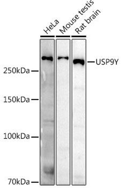 Western blot analysis of extracts of various cell lines, using USP9Y antibody at 1:500 dilution. Secondary antibody: HRP Goat Anti-Rabbit IgG (H+L) at 1:10000 dilution. Lysates/proteins: 25ug per lane. Blocking buffer: 3% nonfat dry milk in TBST. Detection: ECL Enhanced Kit. Exposure time: 180s.