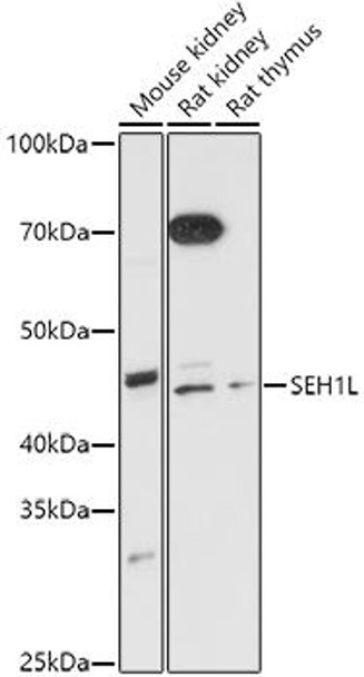 Western blot analysis of extracts of various cell lines, using SEH1L antibody at 1:1000 dilution. Secondary antibody: HRP Goat Anti-Rabbit IgG (H+L) at 1:10000 dilution. Lysates/proteins: 25ug per lane. Blocking buffer: 3% nonfat dry milk in TBST. Detection: ECL Basic Kit. Exposure time: 180s.